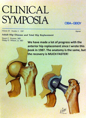 anterior hip replacement precautions