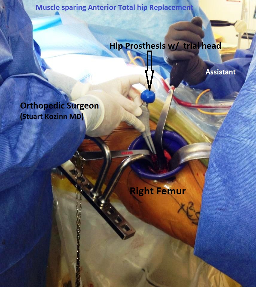 Total Hip Surgery