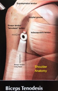 Shoulder anatomy is very complex. The shoulder joint is the only joint in the boday that can do circumduction - 360 degrees of motion !